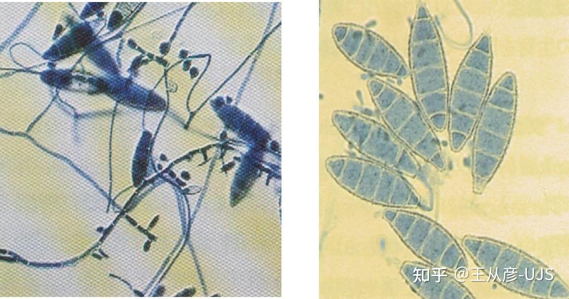 环境微生物之真菌 - 知乎