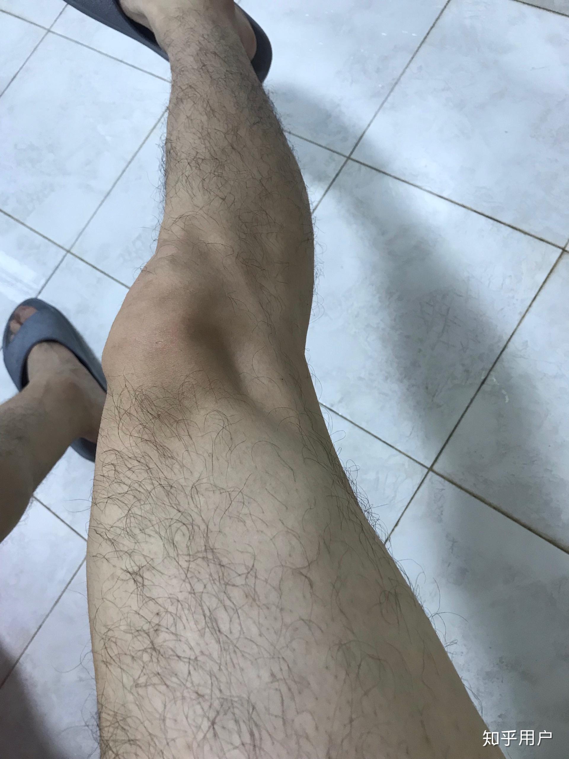 腿毛茂盛的男生夏天应该刮腿毛吗