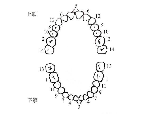 论6号牙有多重要? 知乎