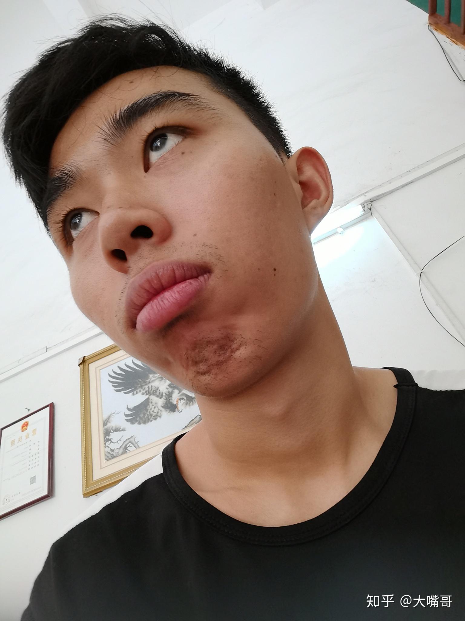 嘴唇厚超级厚超级丑