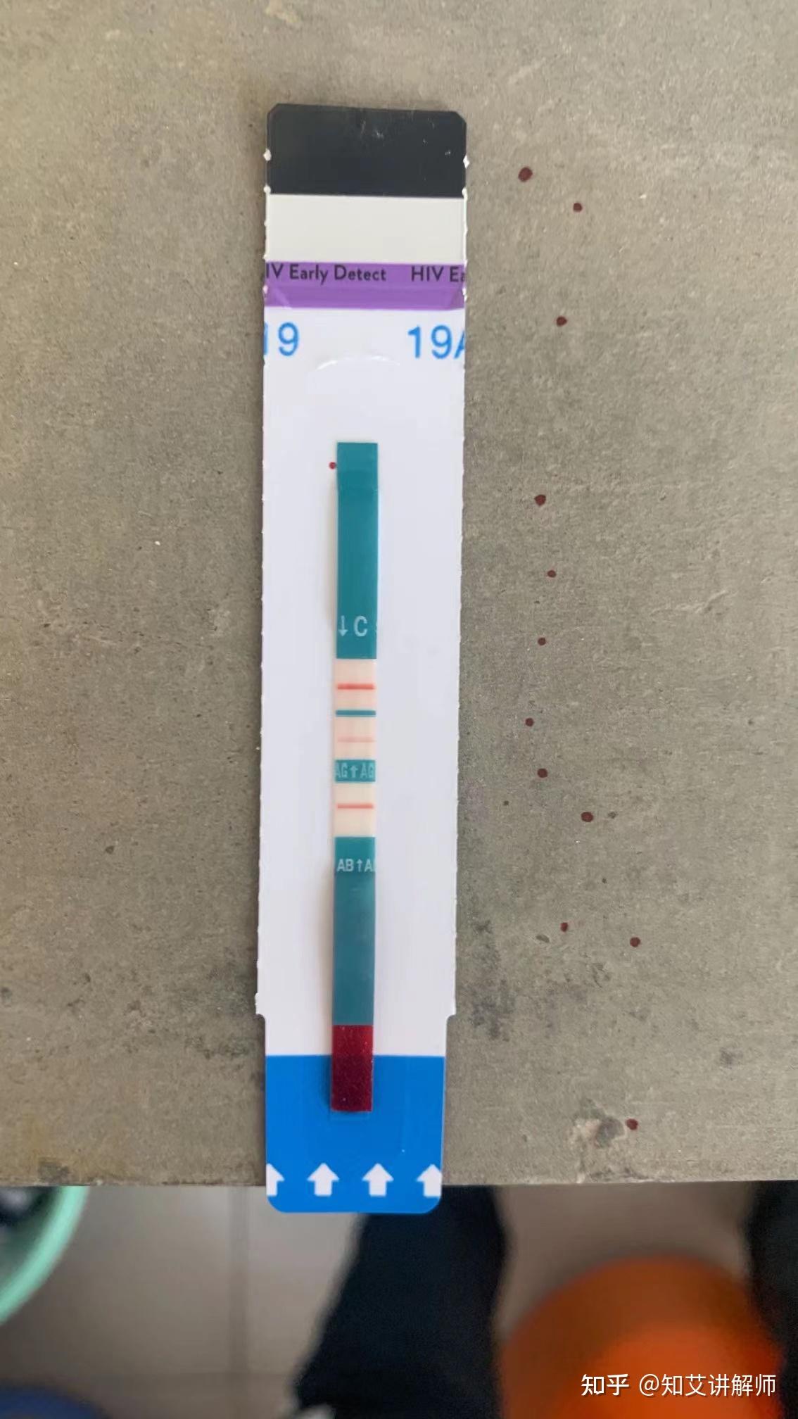 67 写回答 登录/注册 hiv hiv试纸 hiv检测 hiv阳性 雅培四代这是阴