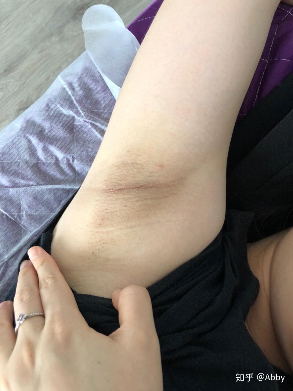 冬天的女人刮不刮腋毛