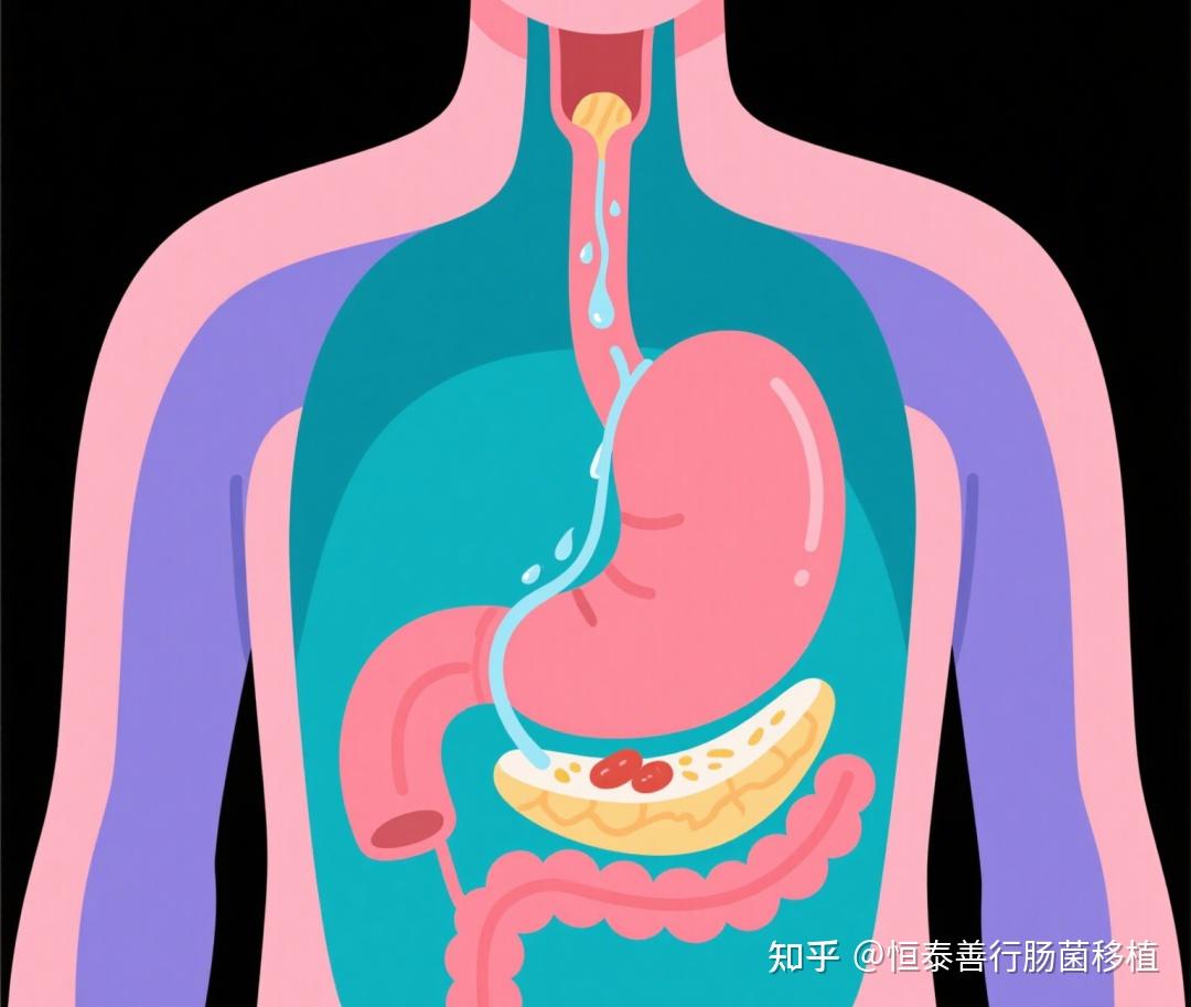 反酸≠小事！长期忽视可能引发食管炎、喉炎甚至癌症 - 知乎