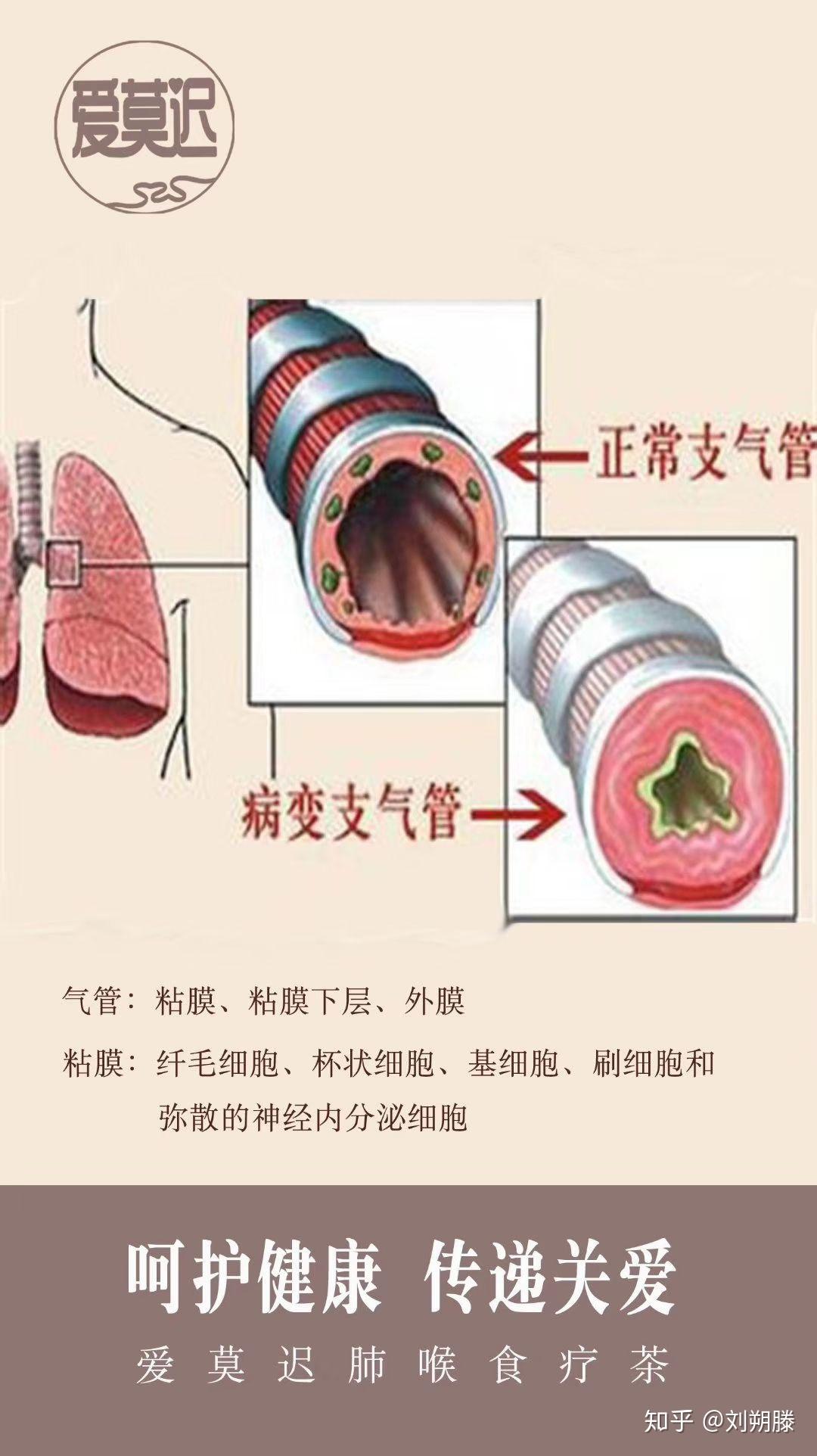 得了支气管炎如果不能及时治疗会带来什么后果? - 知乎