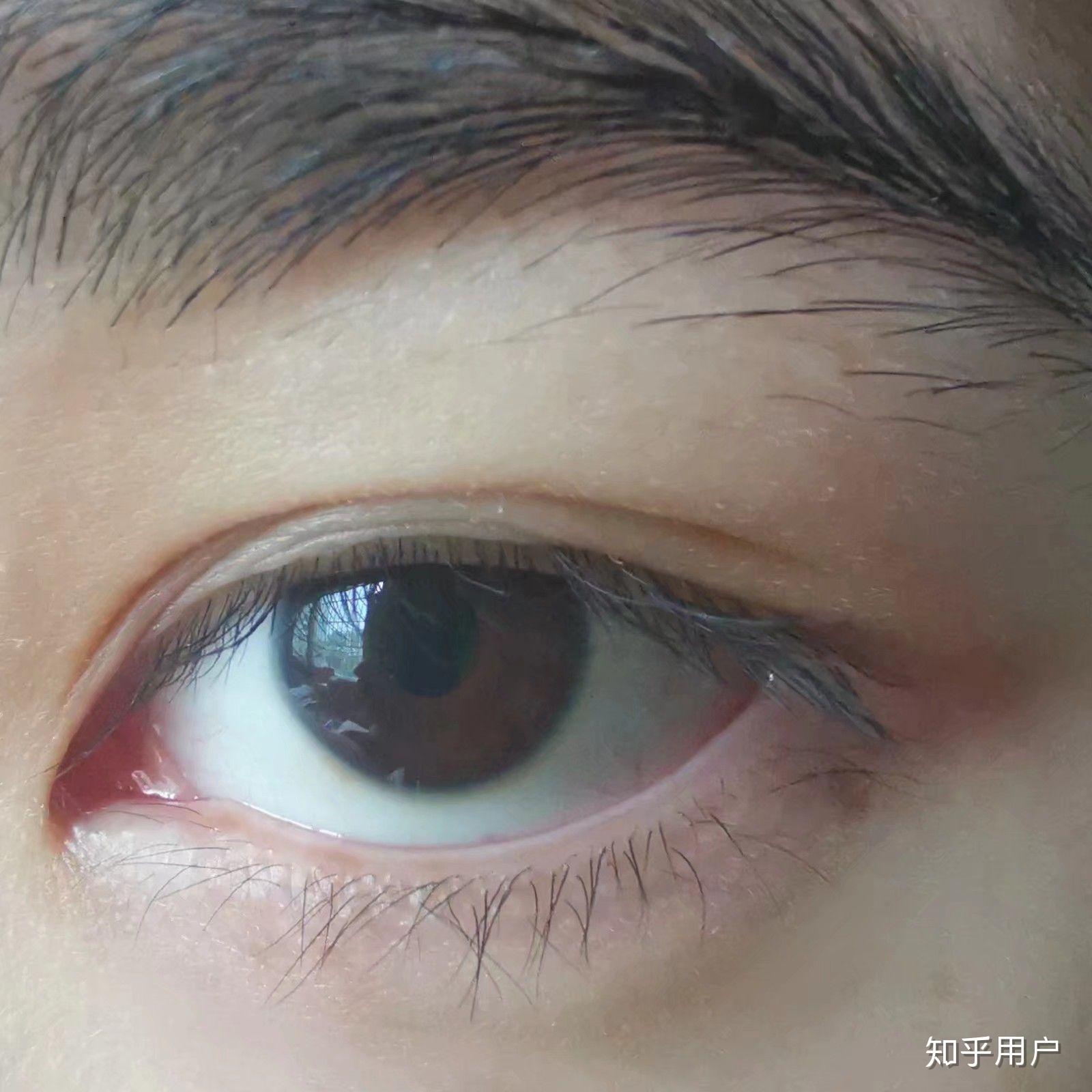 为什么中国人的眼睛是乍看像黑色的棕色,而西方人眼睛的颜色很多?