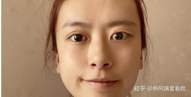 曾海峰/吴溯帆 杭州全切双眼皮手术,医生如何选择? - 知乎