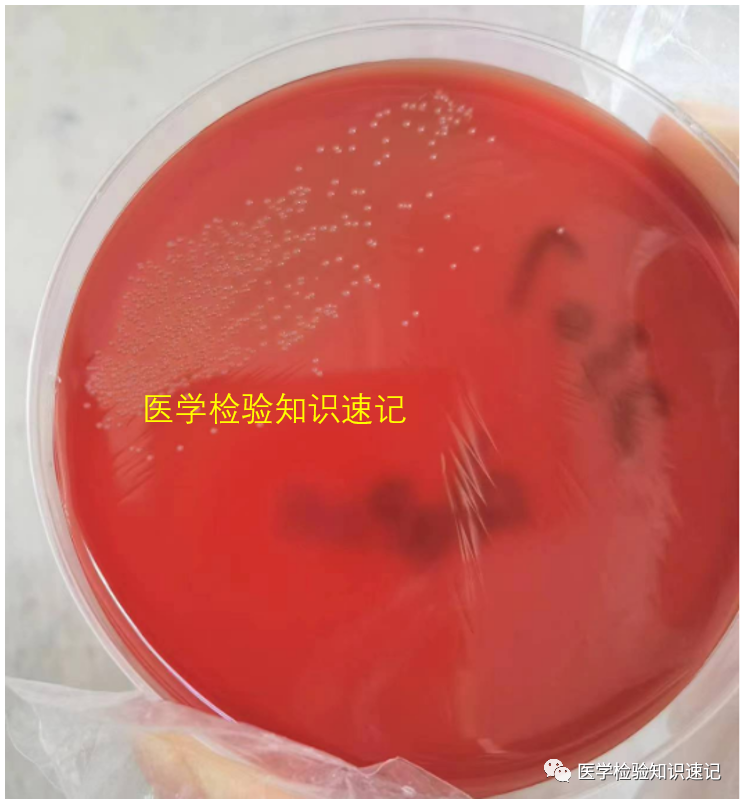 溶血隐秘杆菌 - 知乎