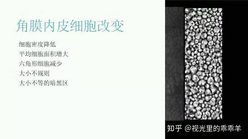 角膜内皮细胞的减少的原因是什么? - 知乎