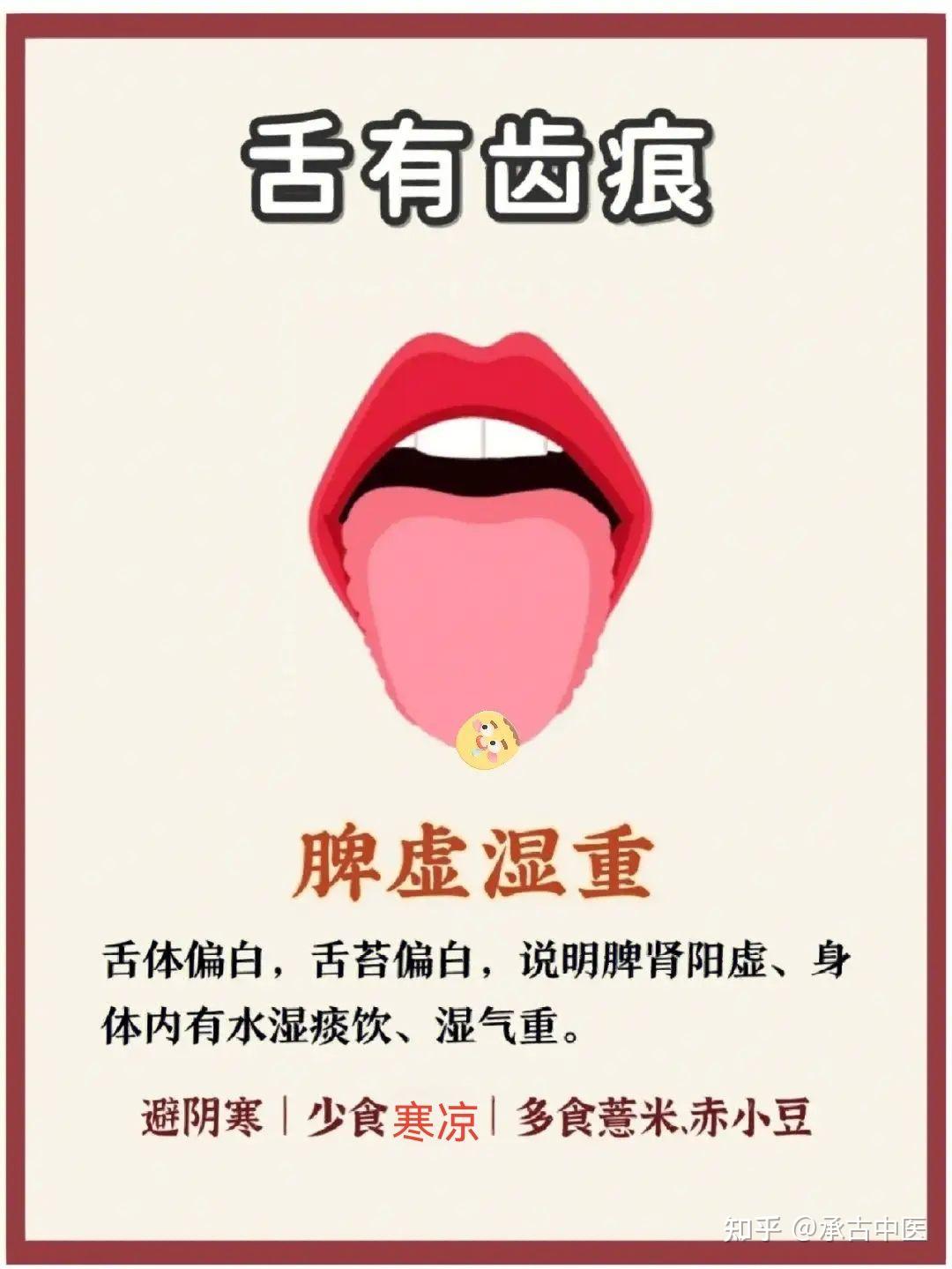 舌诊的原理 - 知乎