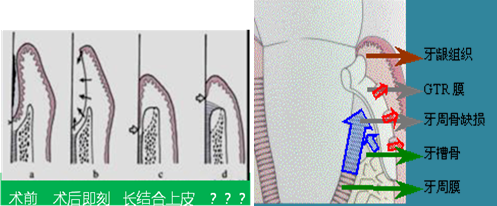 口腔内科学——牙周病学 - 知乎