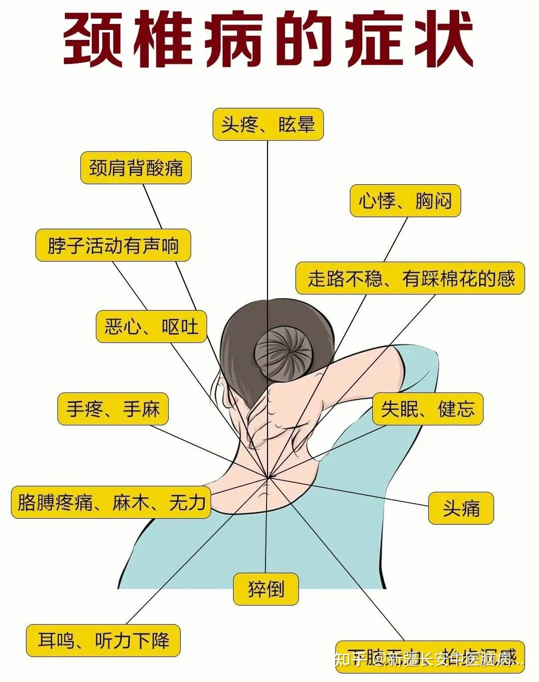 手脚发麻是怎么回事，该挂哪个科？ - 知乎