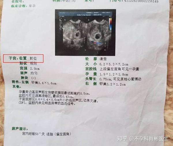 子宫前位与子宫后位,教你如何分清? - 知乎