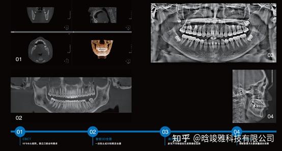 口腔数字化——CBCT - 知乎