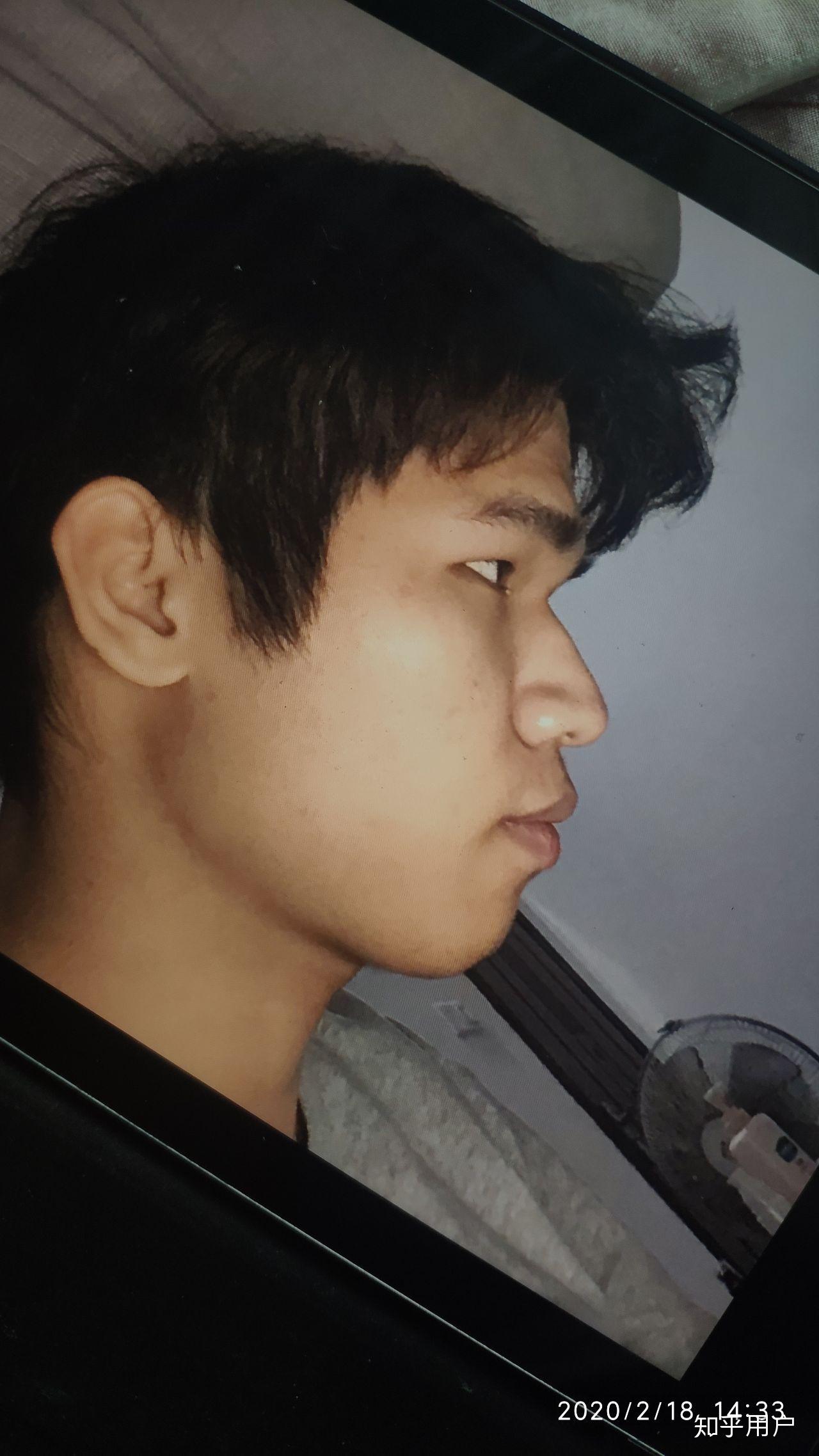 侧脸丑而正脸好看是一种什么体验