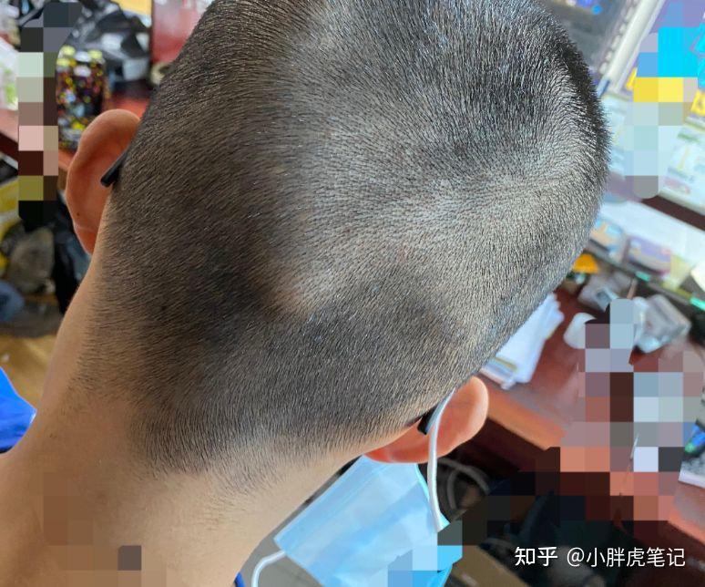 你什么脑后有"反骨" 的人吗?真的不可信任吗?