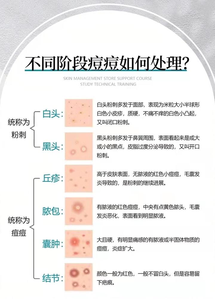 不同阶段痘痘该如何正确处理？ - 知乎