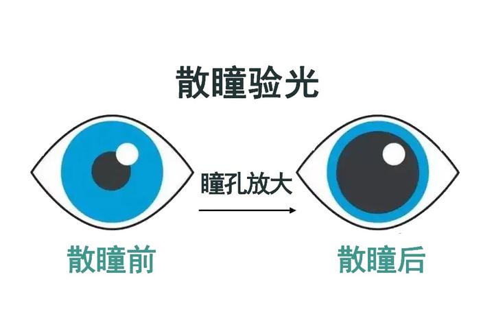 孩子散瞳验光几岁能做？什么情况下必须要散瞳？ - 知乎