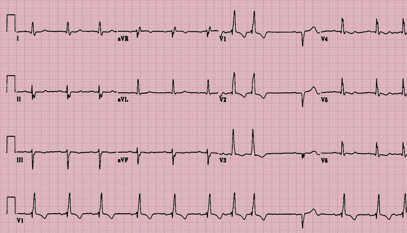 ecg心电图的智能手表和便携设备推荐(2021年最新)