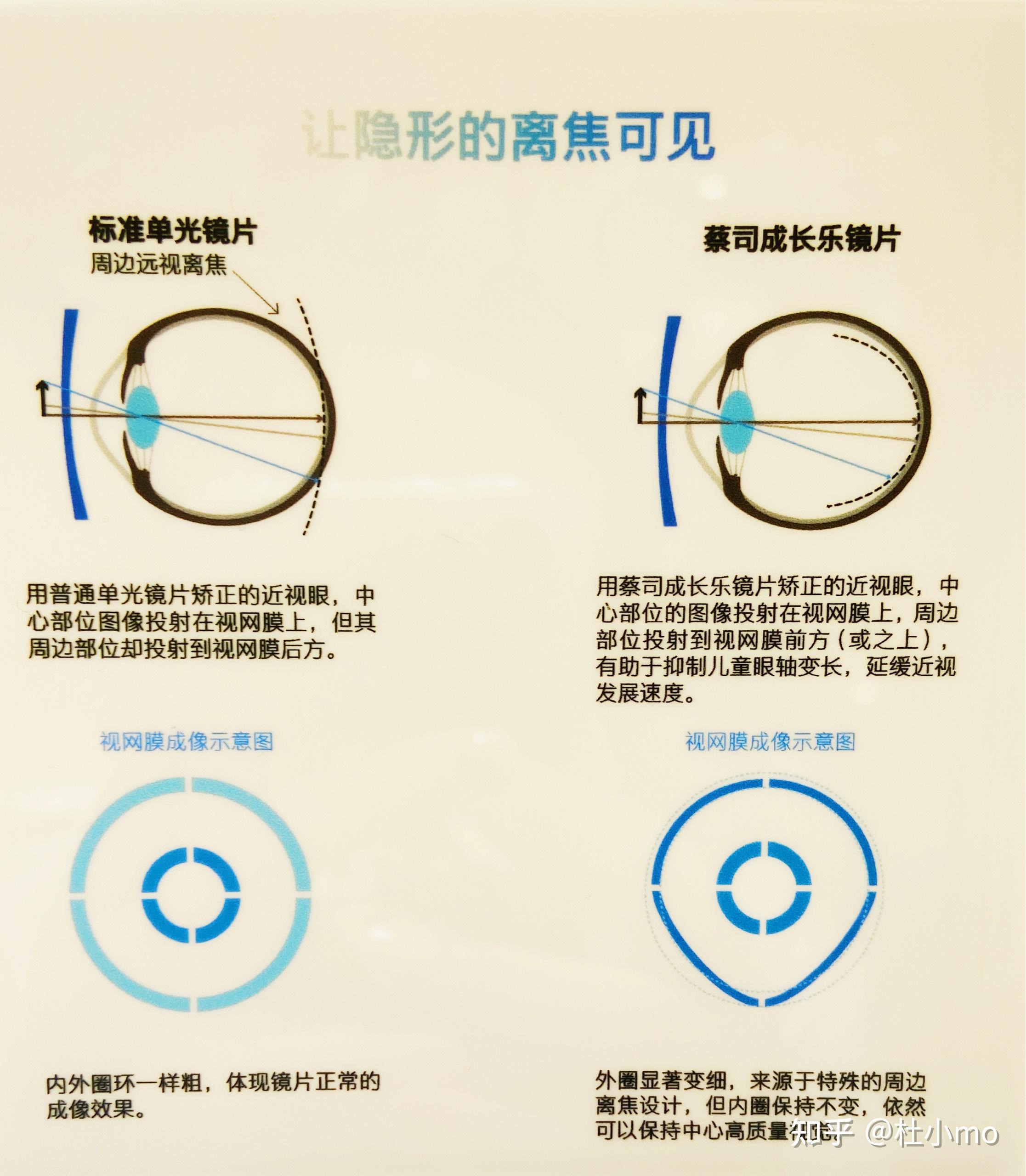 蔡司成長樂鏡片到底好不好