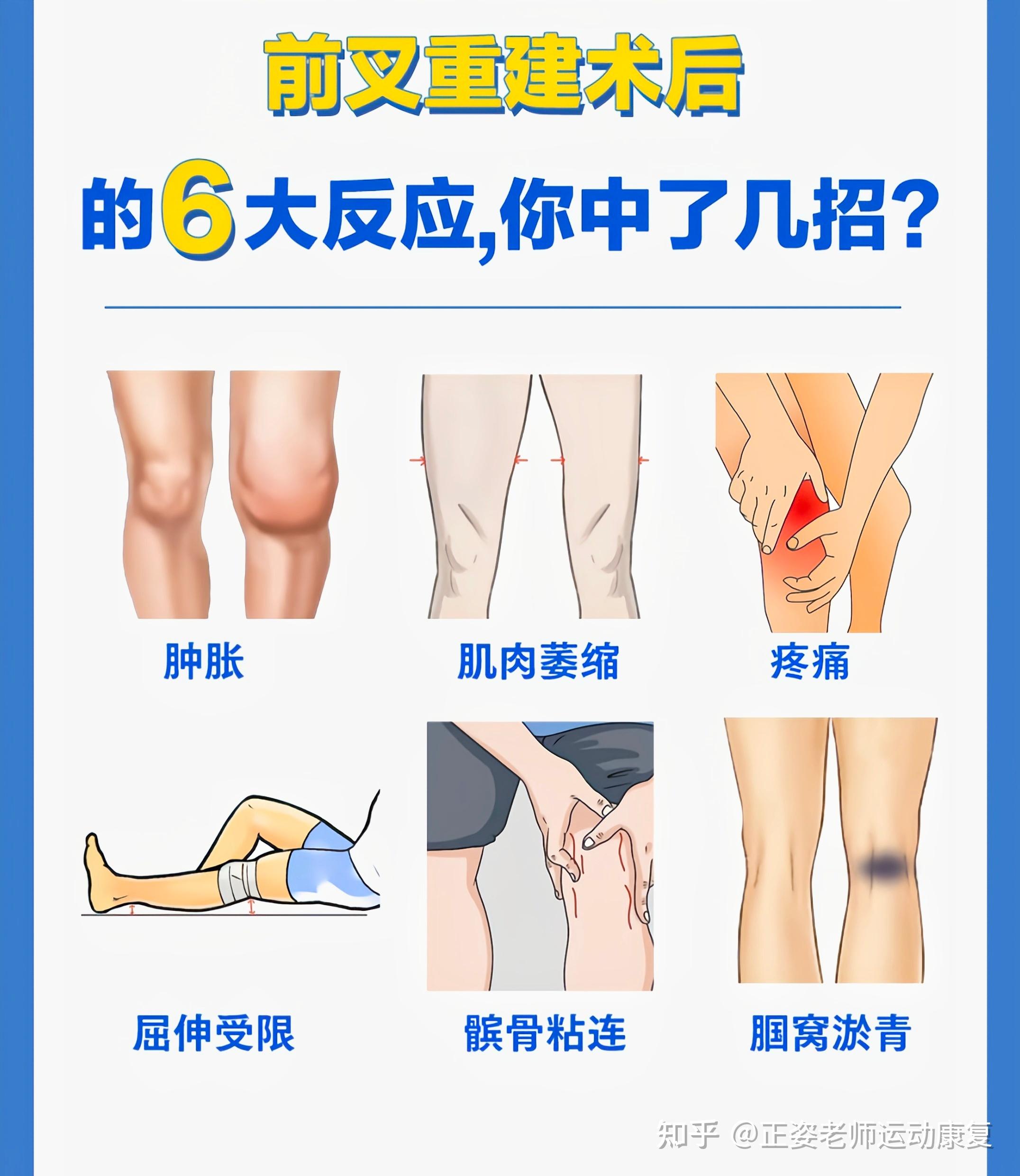 膝关节镜术后屈腿膝盖内侧水肿到底是休息还是继续屈腿