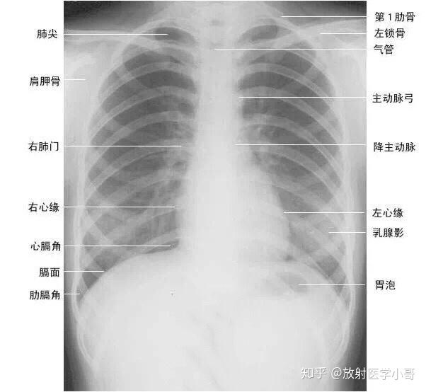 X光片,如此简单。 - 知乎