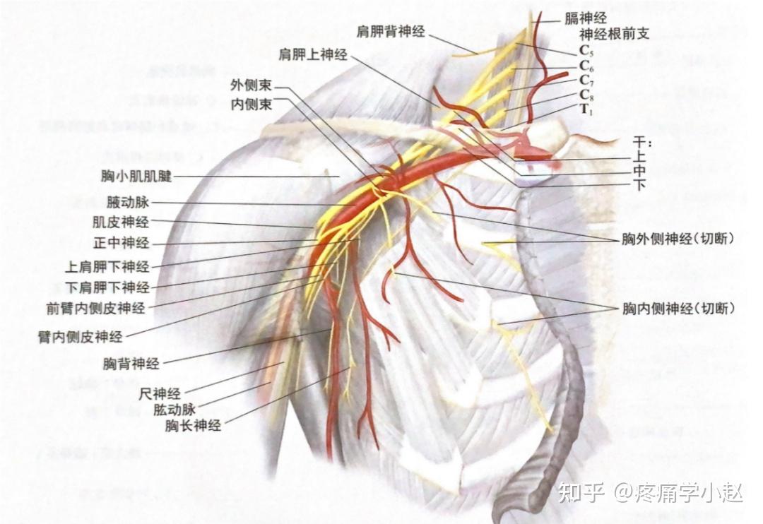 臂丛麻醉定位解剖图图片