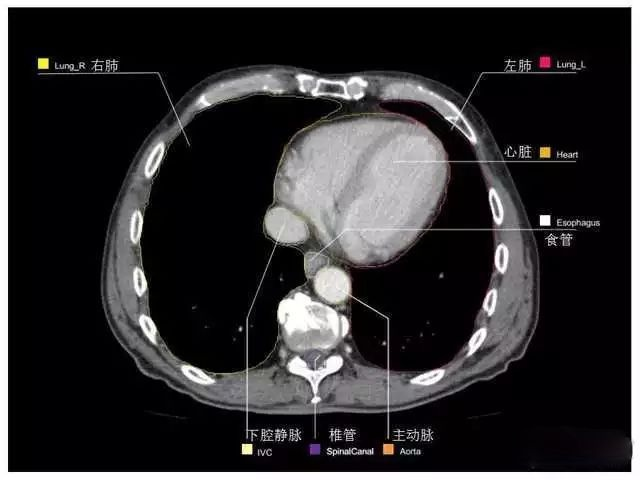 外科医生阅片能力:看完它,再也没有看不懂的腹部CT - 知乎