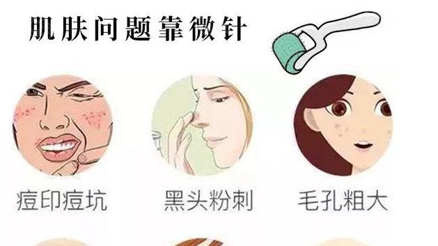 长痘适合什么医美 v2-57c574739ef67a7531b78310eca91fad_1440w.jpg?source=172ae18b