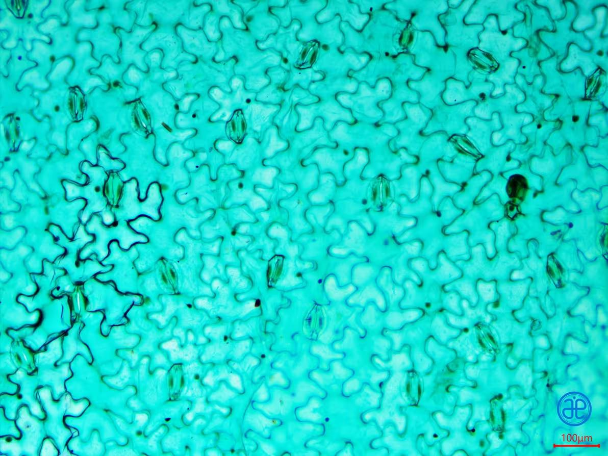蚕豆叶表皮细胞气孔器类型是什么?