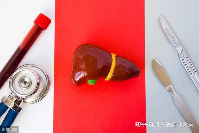 肝硬化TIPS术后的肝癌患者能否行介入治疗? - 知乎