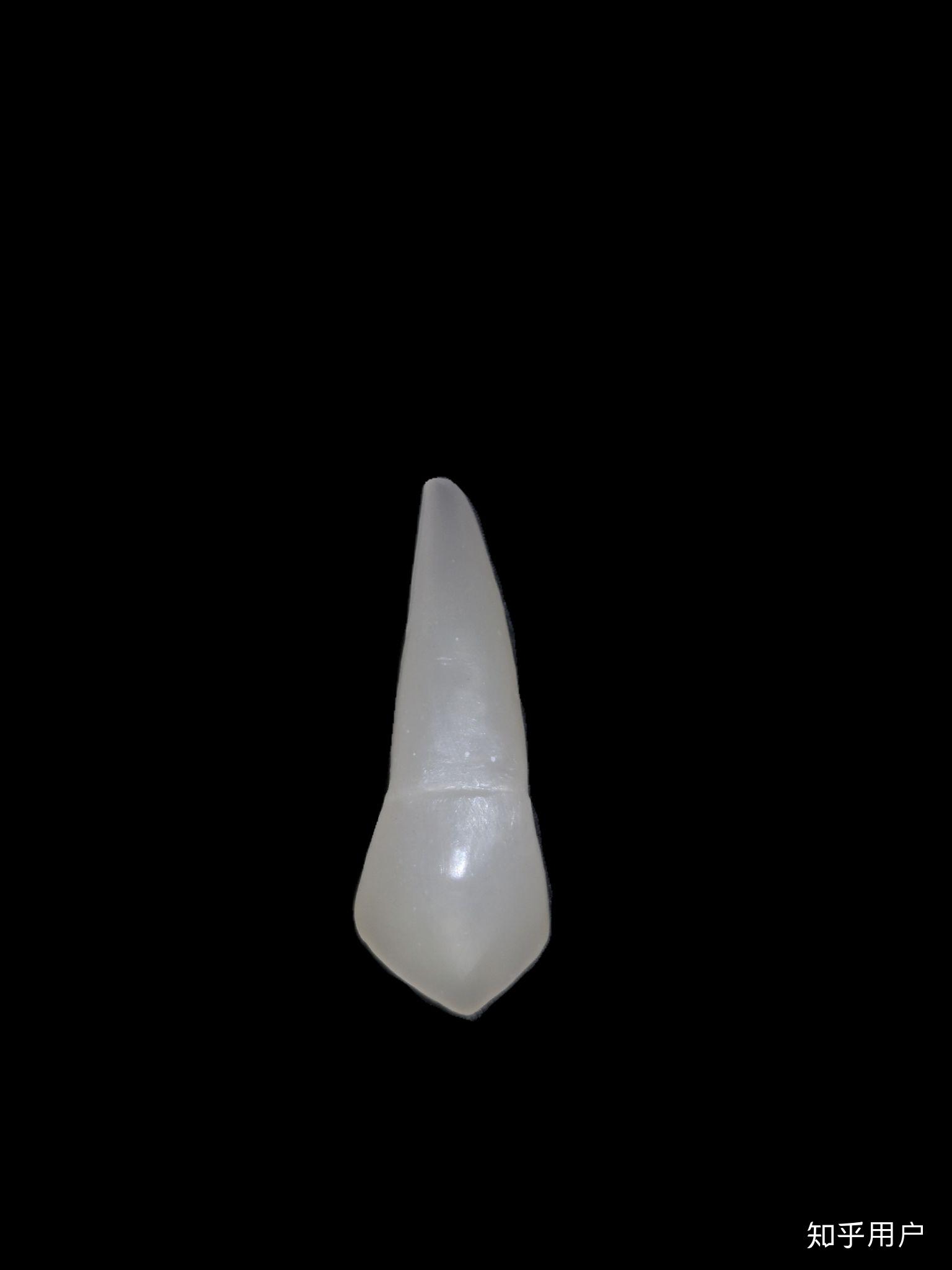 口腔专业的学生雕牙怎么雕好?