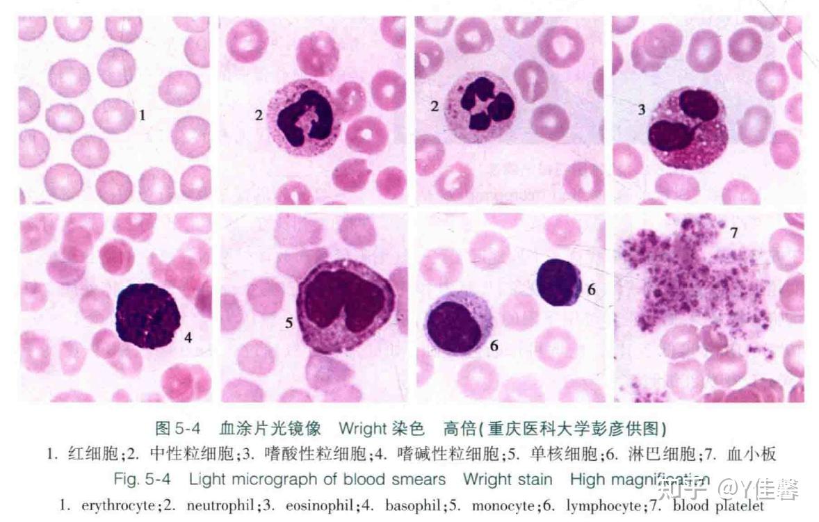 血细胞的光镜结构特点有什么