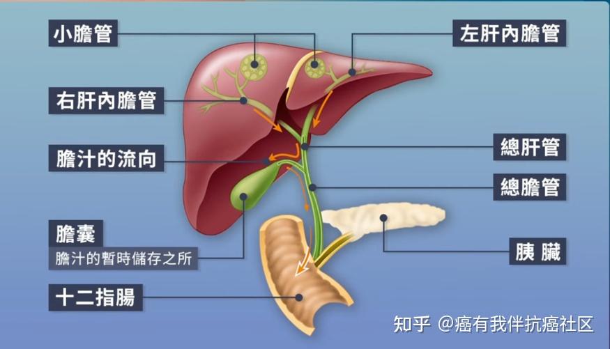 胆管癌的位置图片图片