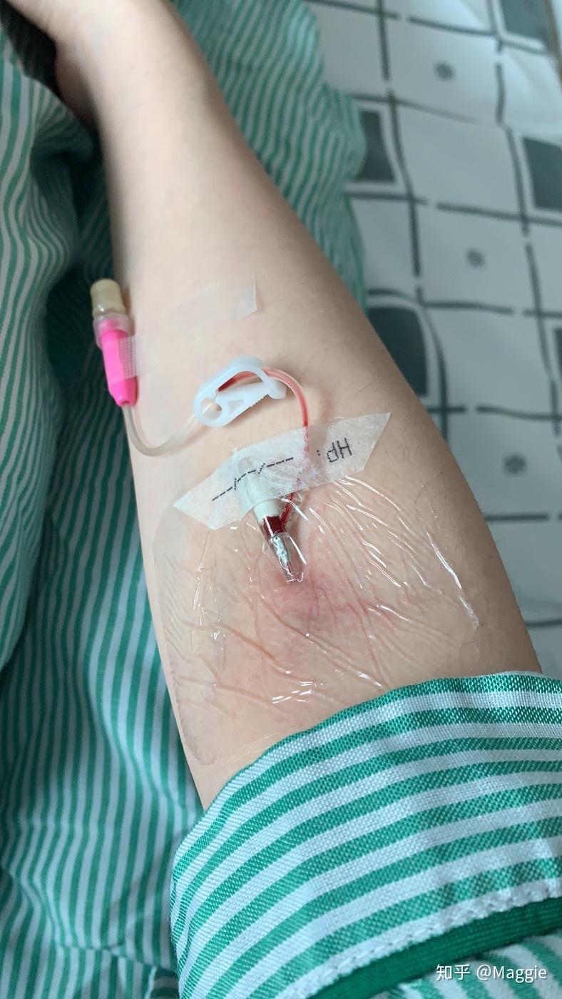 请问 神经鞘瘤的风险性和严重性.手术过程是怎样的?本人今年18岁.