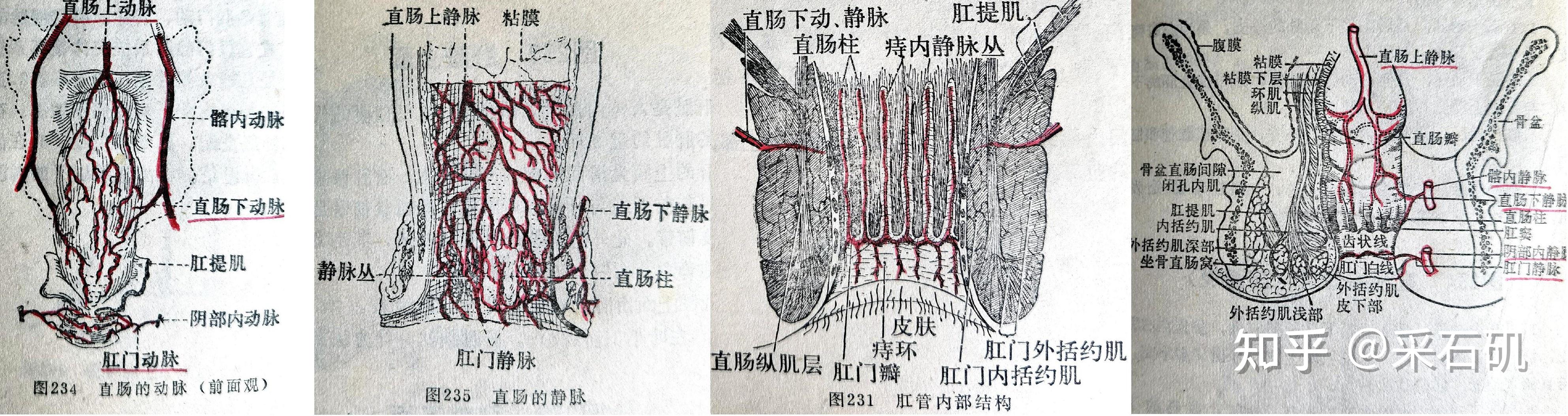 痔疮不开刀能治愈吗? - 知乎