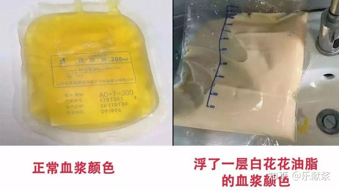 捐献血浆的好处，你知道几个？ - 知乎