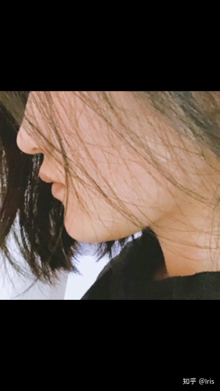 上嘴唇上翘,上翻怎么办?侧面看起来简直丑哭我! - 知乎