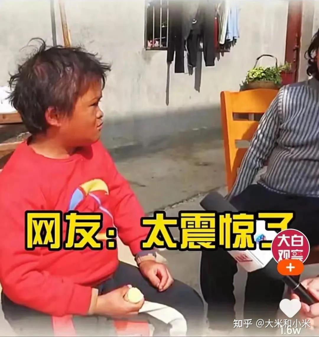 因撞脸马云，智力障碍儿童成职业网红，3年后，他的结局震惊全网…… - 知乎