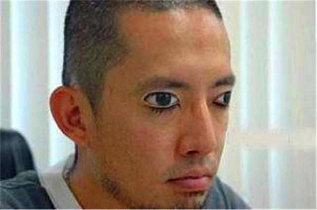 “睁眼睡”属于正常现象吗? - 知乎