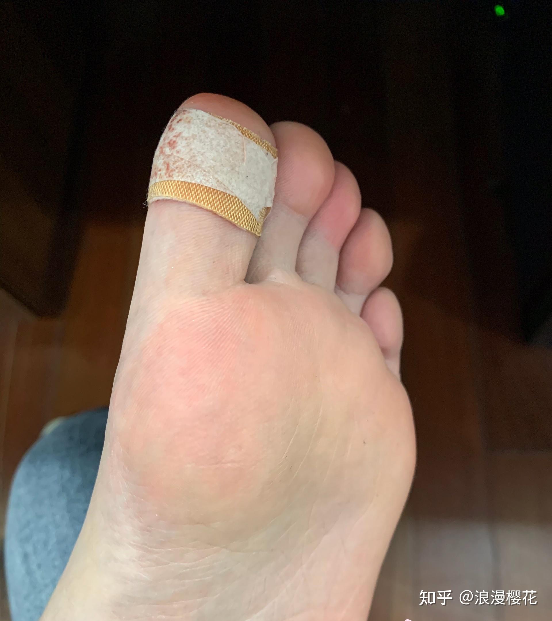 女孩的脚真的都很酸吗