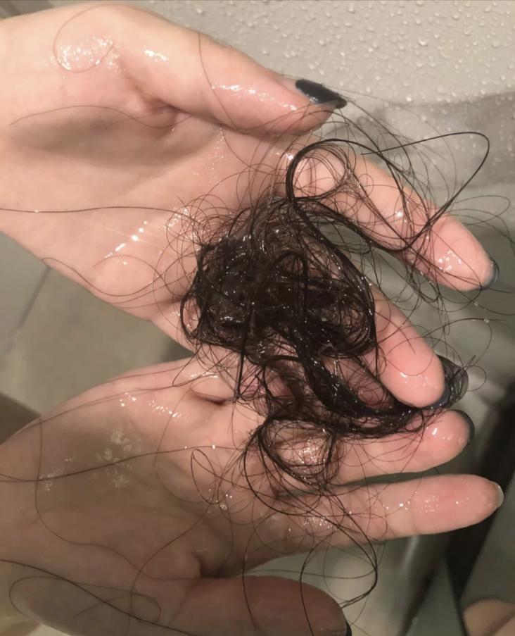 洗头的时候掉头发怎么办