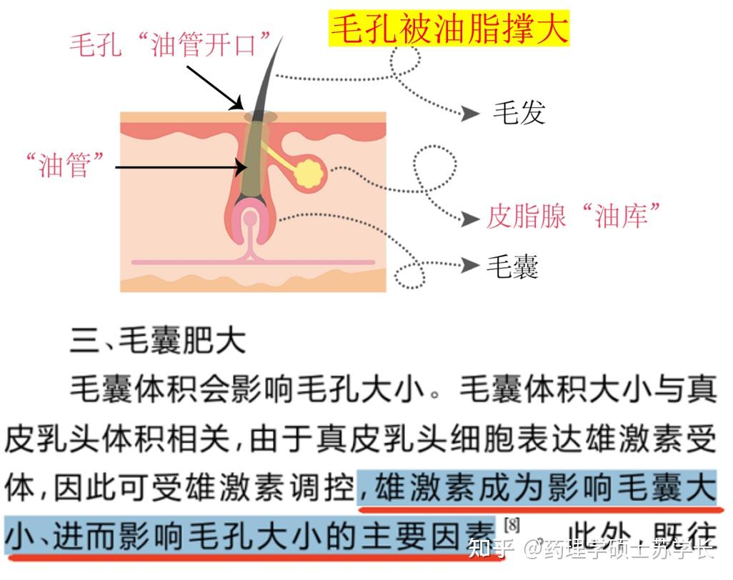 男生毛孔粗大、脸上密密麻麻全是小黑点,究竟怎样才能收缩毛孔?药理学硕士教你一个月拯救毛孔粗大,能救一个是一个!!! - 知乎