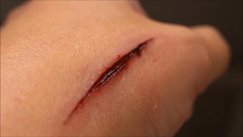 肤蜡学名整塑蜡(adjustable plastic wax),又名塑型蜡,刀伤蜡,刀疤蜡