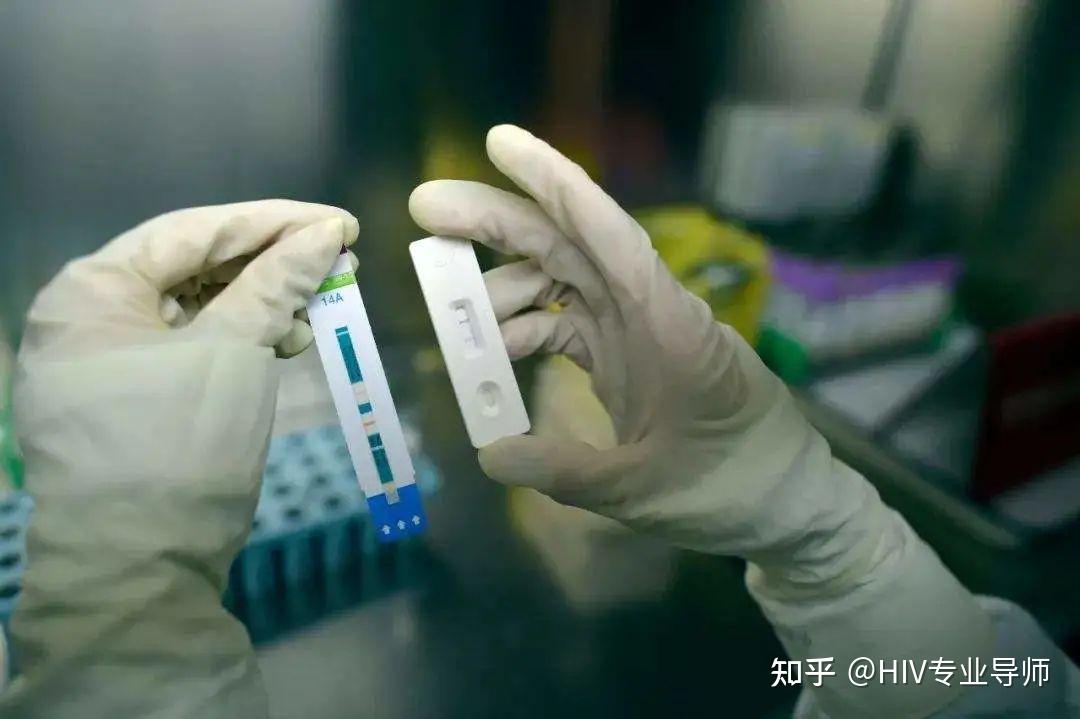 艾滋病多久能查出来
