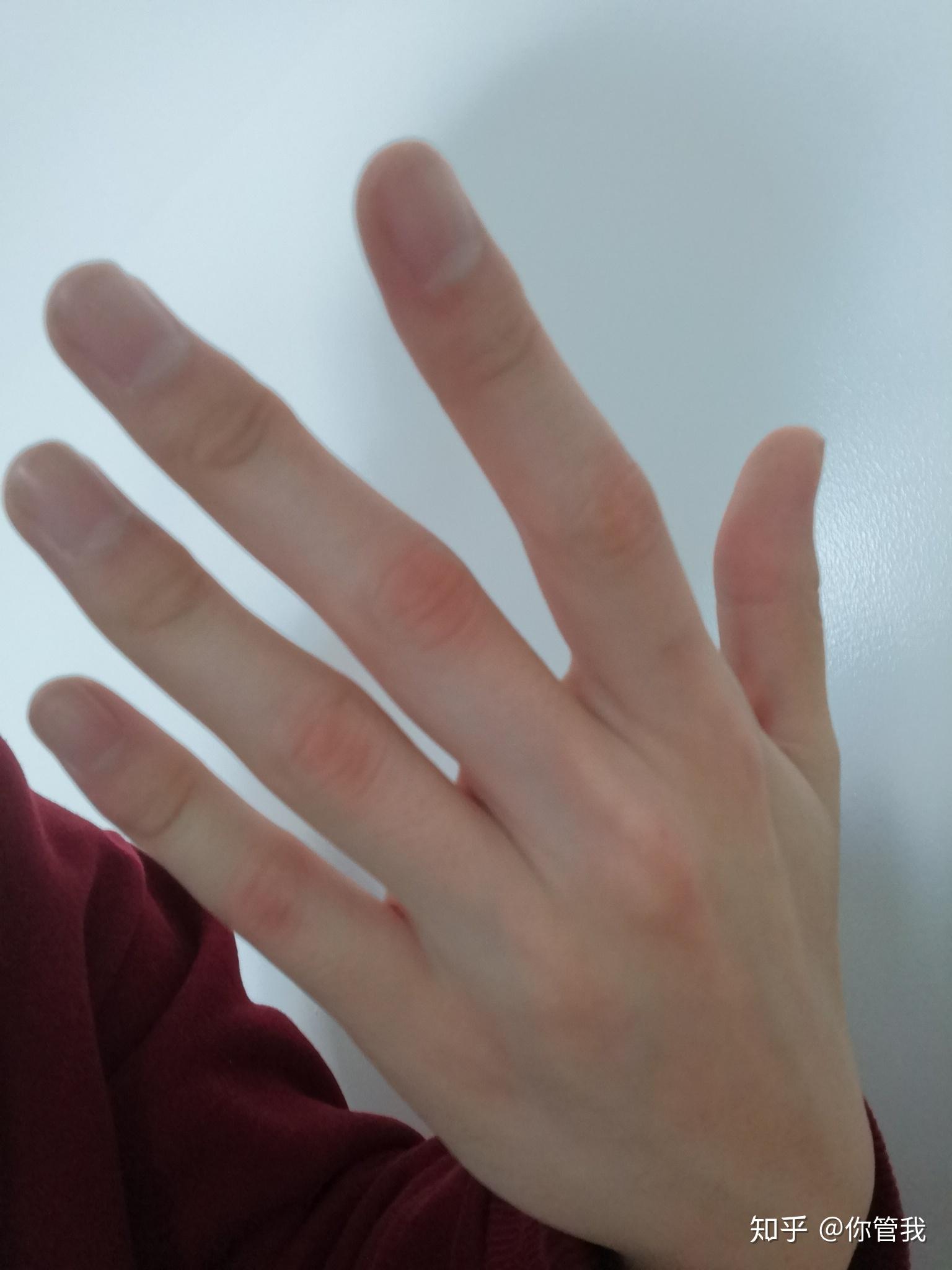如何让手指变得纤细修长