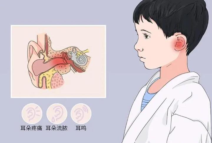 中耳炎艾灸有奇效中耳炎艾灸哪些穴位揭秘