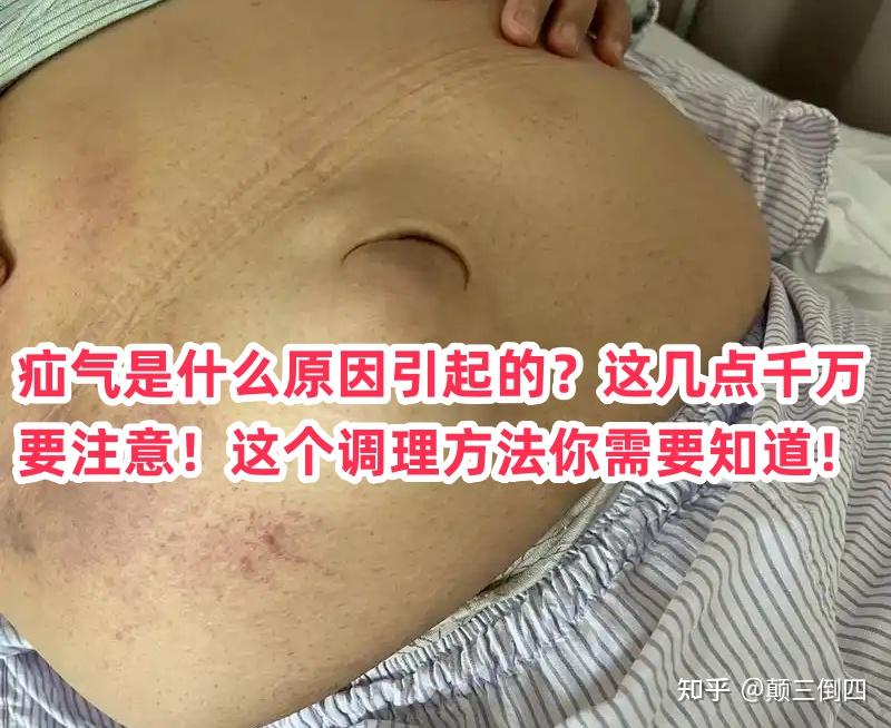 疝气是什么原因引起的?这几点千万要注意!这个调理方法你需要知道! - 知乎