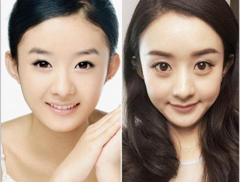 请问一下各位大佬,我的眼睛适合割双眼皮吗,适合什么形状的多宽的