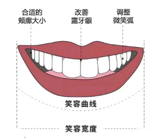正畸微笑线调整|什么叫微笑线？ - 知乎