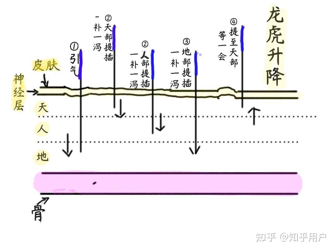 10针刺法之龙虎交战与龙虎升降、五脏交经法、呼吸补泻法、子午捣臼法、十二经络病之治疗法则、下针八法、五俞穴治疗、原络治疗法、俞募治疗法、会郄 ...